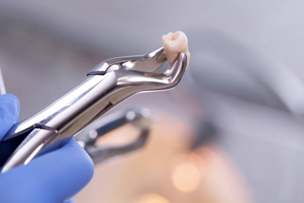 歯科用機器  - tooth ストックフォトと画像