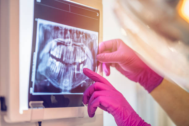 Dentist examining a dental x-ray. Dentist examining a dental x-ray. Only hands are shown. dental cavity stock pictures, royalty-free photos & images