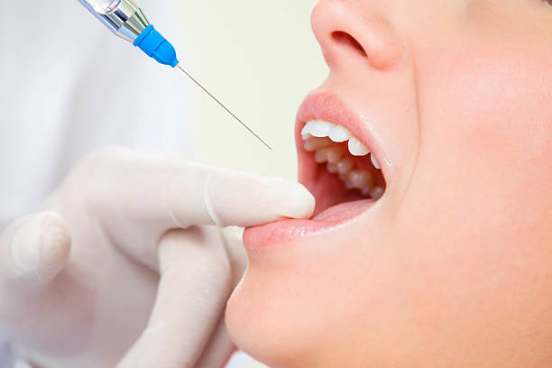 dentist dentist holding a syringe and anesthetizing his patient anesthetic stock pictures, royalty-free photos & images