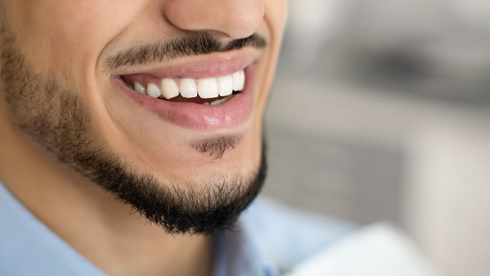 Dentistry Concept. Closeup Of Happy Young Middle Eastern Man Widely Smiling With Perfect Teeth While Sitting In Chair In Dental Clinic, Arab Guy Enjoying Result Of Stomatologic Treatment, Cropped