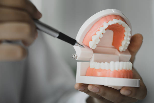 Dentists hold dental models used for dental care consultations, dental clinics, dental and oral treatments and treatments, patients undergo dental care consultations. Dental concept. stock photo