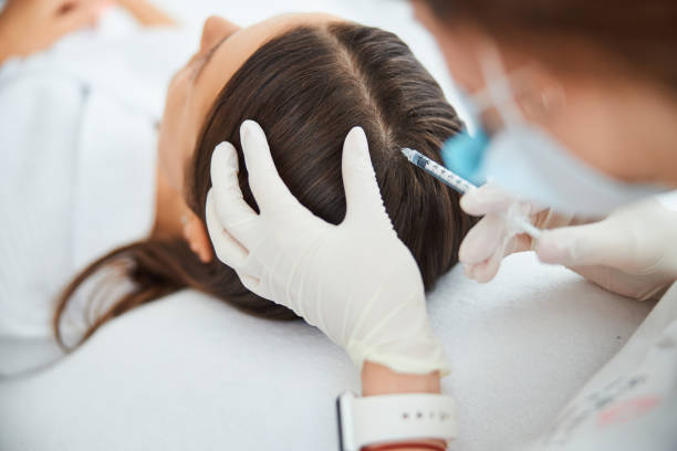 Dermatologist injecting the serum into the female scalp stock photo