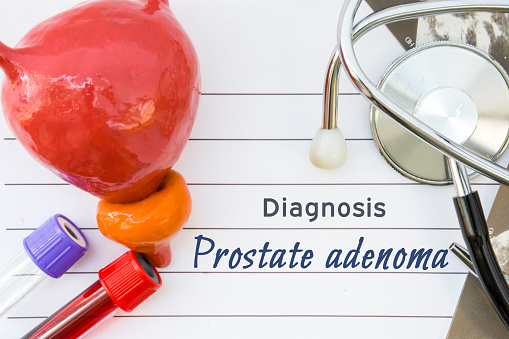 prostatic adenoma diagnosis)