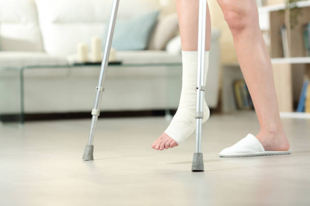 Disabled woman with bandaged foot walks with crutches Side view portrait of a disabled woman with bandaged foot walking with crutches at home ankle stock pictures, royalty-free photos & images