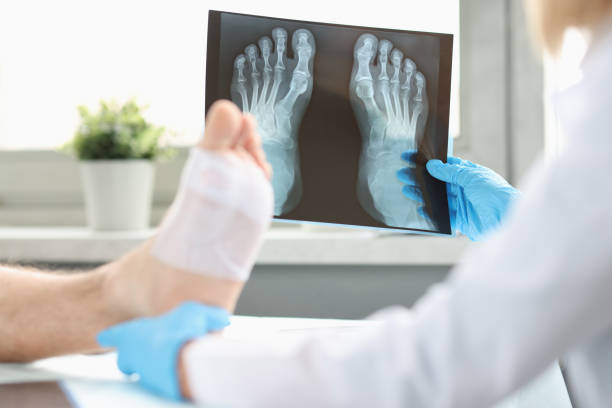 Doctor conducts physical examination of patient with bandaged leg and examines X-ray image stock photo