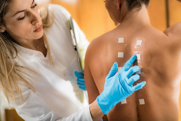 Doctor Doing Skin Allergy Test Immunologist Doing Skin Prick Allergy Test on a Woman’s Back allergy test stock pictures, royalty-free photos & images