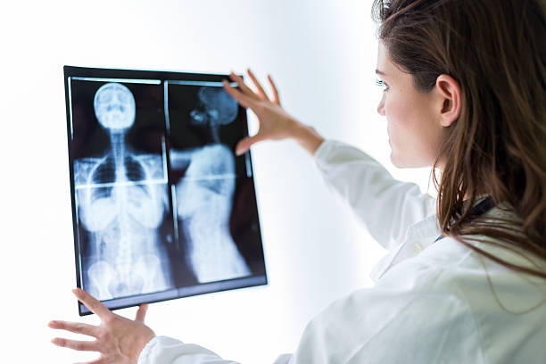 Doctor examining x-ray Doctor examining x-ray  medical x ray stock pictures, royalty-free photos & images