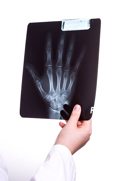 Doctor exams a X Ray picture Doctor exams a X Ray picture of her Patients Hand x ray photograph stock pictures, royalty-free photos & images
