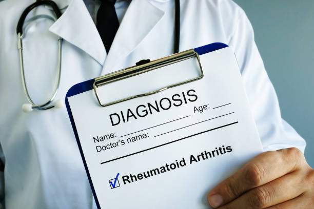 arzt hält zwischenablage mit diagnose rheumatoide arthritis. - gelenkrheumatismus stock-fotos und bilder
