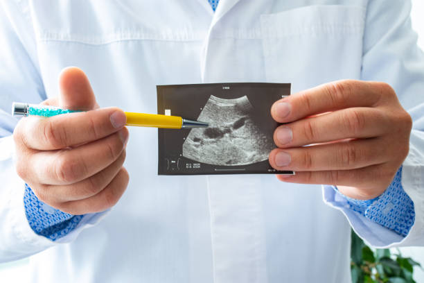 Doctor holds before itself and shows patient printed picture with ultrasound examination of gallbladder, pointing with a pen on gallbladder and its pathology. Concept photo ultrasonic  biliary system
