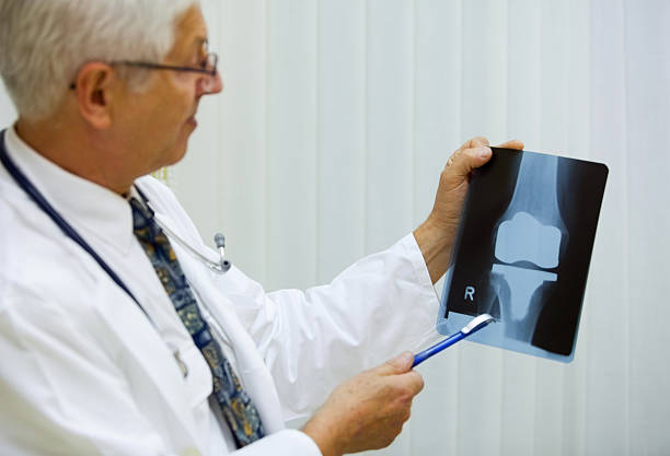 Doctor is examining X-ray image of artificial knee stock photo