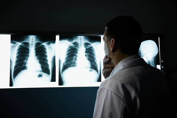Doctor looking at chest x-rays in dark room Male doctor at work in public medical clinic and examining x-ray plates of bones, skull and lungs x ray plates stock pictures, royalty-free photos & images