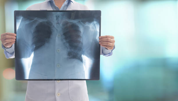 doctor radiology doctor radiology looking chest x-ray film of lung disease patient at hospital ward. x ray image stock pictures, royalty-free photos & images