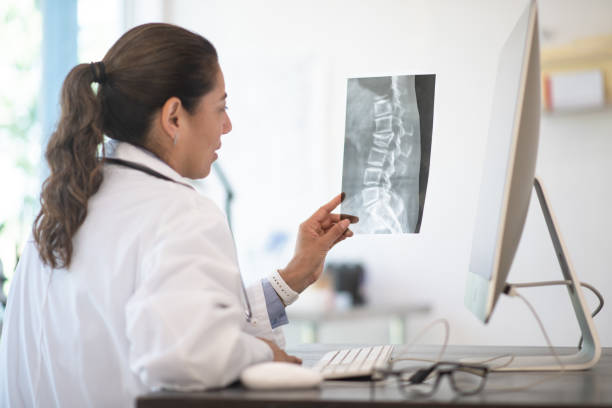 A Doctor Reviewing X-ray Results stock photo A Doctor reviewing her patients x-ray results for possibly breaks, fractures and abnormalities bone fracture stock pictures, royalty-free photos & images