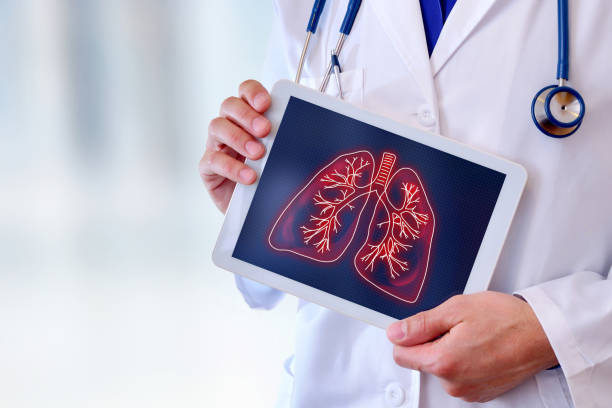 Doctor showing lungs on a table close up stock photo