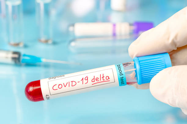 Doctor with a positive blood sample for the new variant detected of the coronavirus strain called covid DELTA. Research of new strains and mutations of Covid 19 coronavirus in the laboratory stock photo