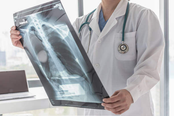 Doctor with radiological chest x-ray film for medical diagnosis on patient's health on asthma, lung disease and bone cancer illness  heart image stock pictures, royalty-free photos & images