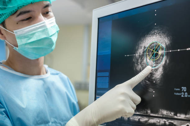 Doctor working at Intravascular ultrasound imaging (IVUS) stock photo