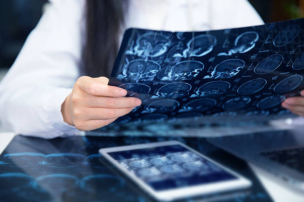 doctor working with magnetic resonance image (MRI) of the brain doctor hand checking magnetic resonance image (MRI) of the brain x ray image photos stock pictures, royalty-free photos & images