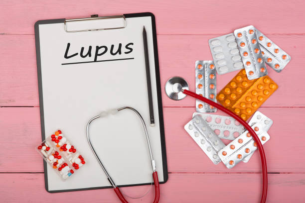 Doctor workplace with clipboard and text "Lupus", medicine red stethoscope and pills on pink wooden table stock photo