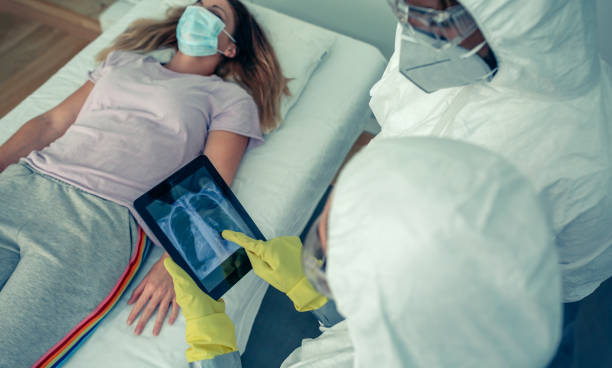 medici che esaminano la radiografia del torace di un paziente - pandemia malattia foto e immagini stock