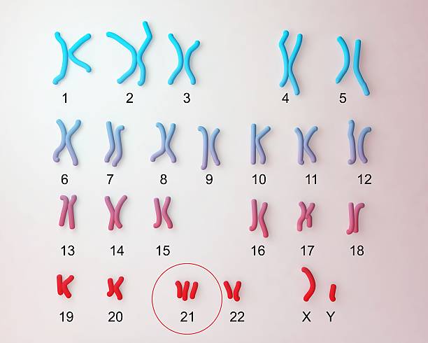 Down-syndrome karyotype Down-syndrome karyotype, male labeled. Trisomy 21 3D illustration chromosome stock pictures, royalty-free photos & images