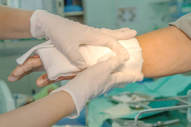 Dressing burned wound Dressing burned wound hand with gauze pad burning stock pictures, royalty-free photos & images