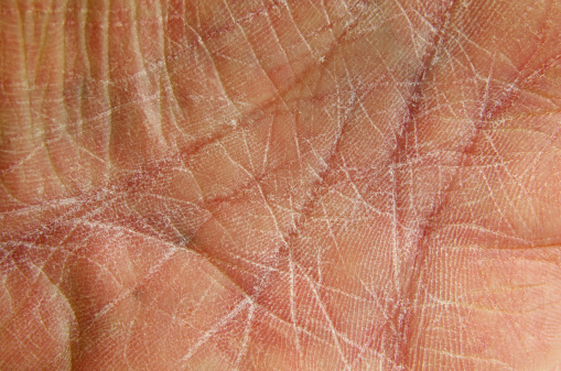 The palm of a rough and worn human hand showing dry skin. Close-up.