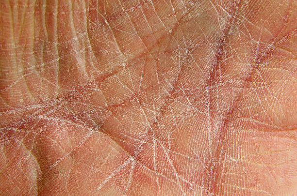 Dry Skin as shown on chapped hand-palm. The palm of a rough and worn human hand showing dry skin. Close-up. human body macro stock pictures, royalty-free photos & images