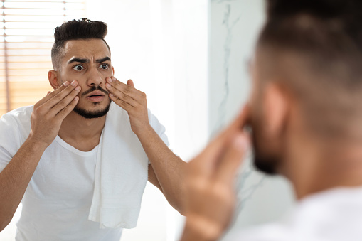 Dull Skin Concept. Worried Arab Guy Looking At Mirror And Touching Face, Shocked Young Middle Eastern Man Examining Dark Circles Under Eyes While Standing In Bathroom At Home, Selective Focus