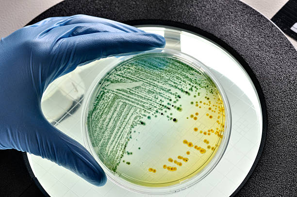 E.coli bacteria growing in dish stock photo