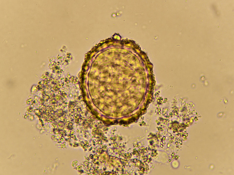 Egg of Ascaris lumbricoides (roundworm) in human stool, analyze by microscope, 400x