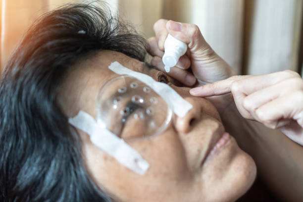 Elderly patient woman having eye drop care treatment on Age-related eye diseases, AMD, cataract, Diabetic retinopathy, Glaucoma, low vision, dry eyes illness for Eye health awareness concept Elderly patient woman having eye drop care on Age-related eye diseases, AMD, Diabetic retinopathy, Glaucoma, low vision, dry eyes diabetes awareness stock pictures, royalty-free photos & images