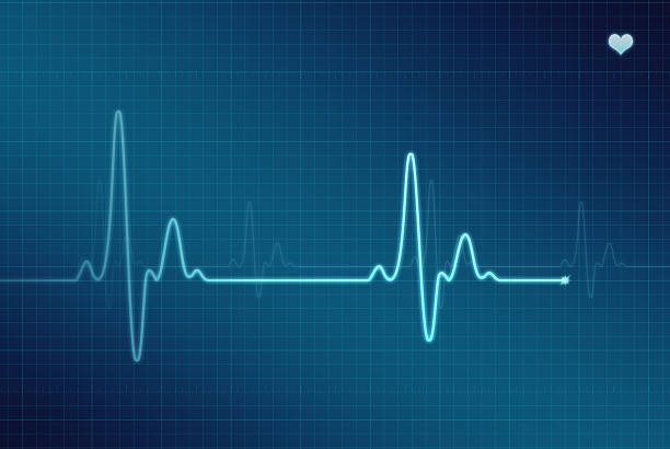 EKG - Electrocardiogram (XXL) Illustration of an electrocardiogram (ECG / EKG). heart rate stock pictures, royalty-free photos & images