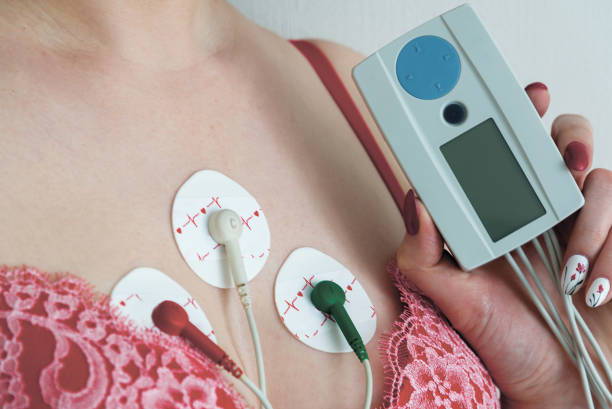 Electrodes Holter monitoring on the chest of woman stock photo