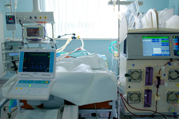 Emergency patient in critical state with intraaortic balloon pump and extracorporeal circuit hemodialysis assist stock photo