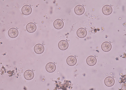 スツール試験における赤痢大腸菌原虫。 - ストックフォト・写真素材...
