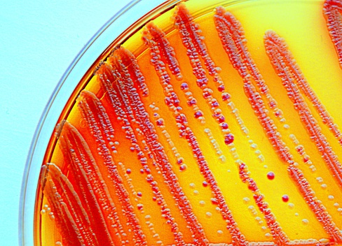 Enterobacteria grown on a selective agar plate. Part of the commensal microbion.