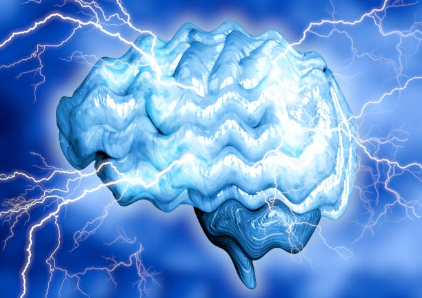 Epilepsy is a chronic brain disease caused by increased electrical activity of neurons. It manifests through involuntary convulsions and momentary loss of consciousness. stock photo