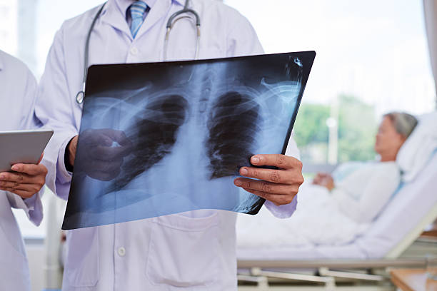 examining chest x-ray - borstkas stockfoto's en -beelden