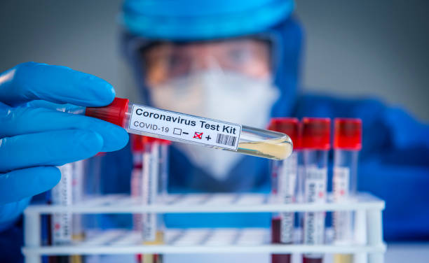 untersuchung des coronavirus covid 19 medizinische proben auf kits neuartigen coronavirus ausbruch - corona test stock-fotos und bilder