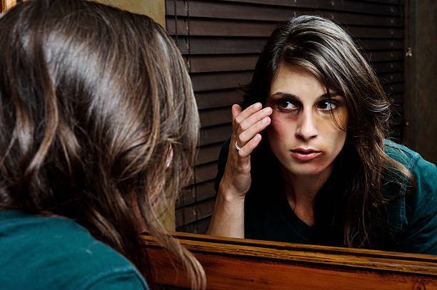 Extent of injuries; domestic abuse concept  black eye stock pictures, royalty-free photos & images