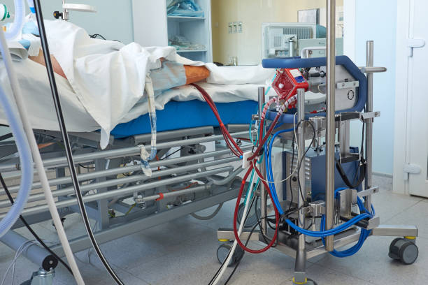 Extracorporeal membrane oxygenation Extracorporeal membrane oxygenation. Working ecmo machine in intensive care department in patient with RDS caused by virus pneumonia membrane stock pictures, royalty-free photos & images