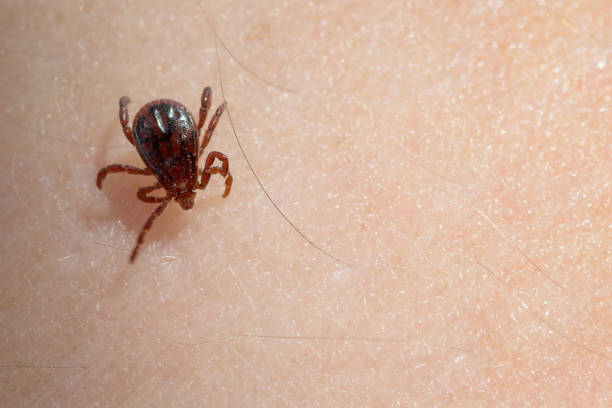 Extreme close-up of brown dog tick crawling on human skin stock photo