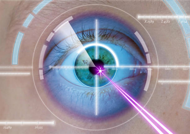 eye laser correction eye laser correction eye doctor stock pictures, royalty-free photos & images