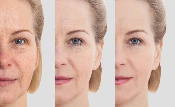 gezicht zonder make-up. middelbare leeftijd dicht omhoog vrouwengezicht vóór na kosmetische. huidverzorging voor gerimpelde gezicht. voor-na anti-aging facelift behandeling. gezichtsverzorging en contouren. - huidverbeterende  stockfoto's en -beelden