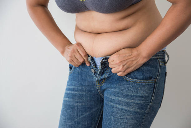 Cool sculpting for belly fat