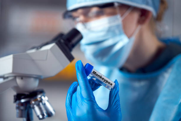 female lab research worker wearing ppe holding test tube labelled monkeypox - monkeypox imagens e fotografias de stock
