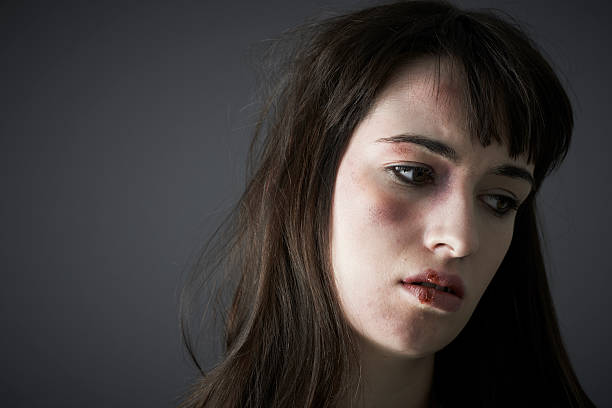 Female Victim Of Domestic Abuse Female Victim Of Domestic Abuse black eye stock pictures, royalty-free photos & images