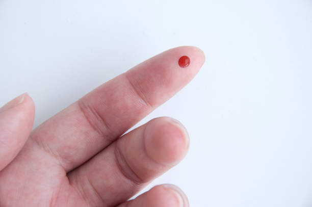 Finger pin prick test Close up of a finger outstretched following a pin prick test blood testing stock pictures, royalty-free photos & images